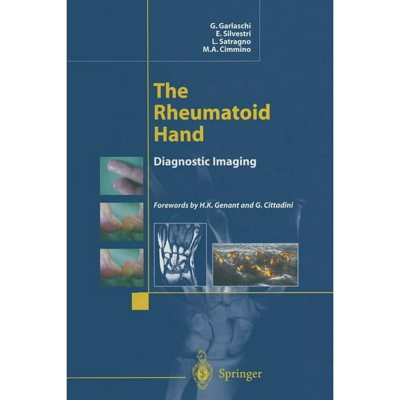 The Rheumatoid Hand: Diagnostic Imaging, (Paperback)