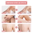 thumbnail image 5 of Crema exfoliante corporal HUOGUO Peach para limpieza profunda y blanqueamiento de la piel, 5 of 5