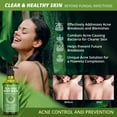 thumbnail image 2 of Antifungal Body Wash & Soap, Antibacterial Tinea Versicolor Body Wash, Tea Tree Back Acne, Folliculitis Body Wash, For Jock Itch, Athletes Foot, Body Odor, Ringworm, 2 of 3
