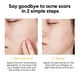 thumbnail image 4 of Clearance, Salicylic Acne Removing Gel - Facial Oil Control And - Lightens Acne - Promotes Skin Metabolism, 4 of 4