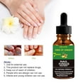 7 Days Nail Fungal Treat Serum 50ml Nail Repair Liquid Foot Toe Fungus ...