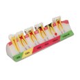 thumbnail image 2 of Modelo de caries dental, 6 etapas diferentes, modelo de exhibición de dientes cariados de resina, 2 of 8