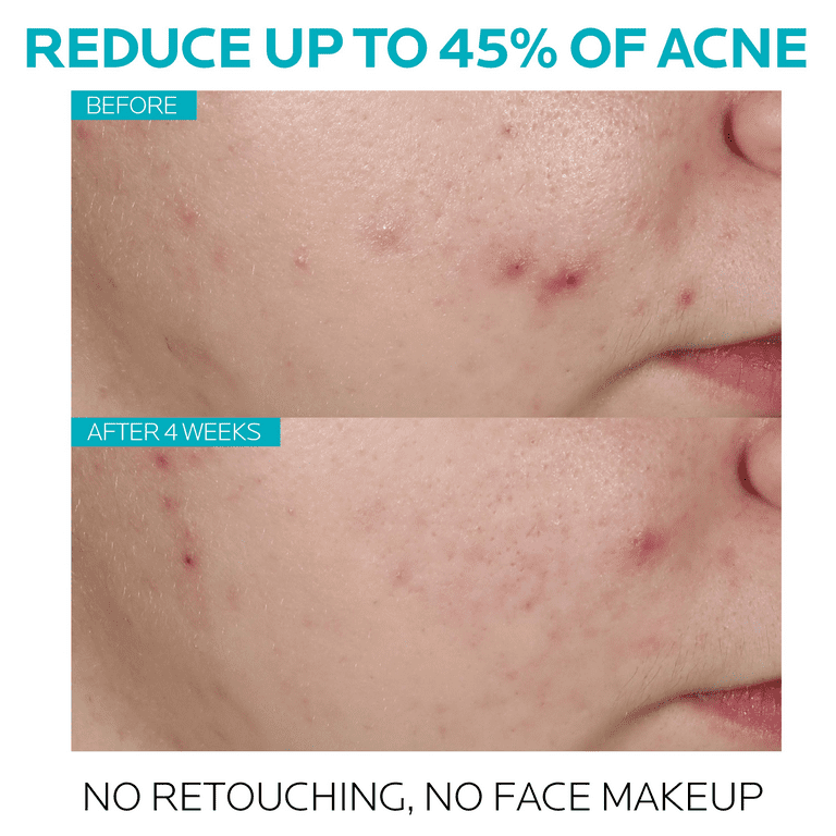 La Roche-Posay Effaclar Salicylic Acid Acne Serum photo 4