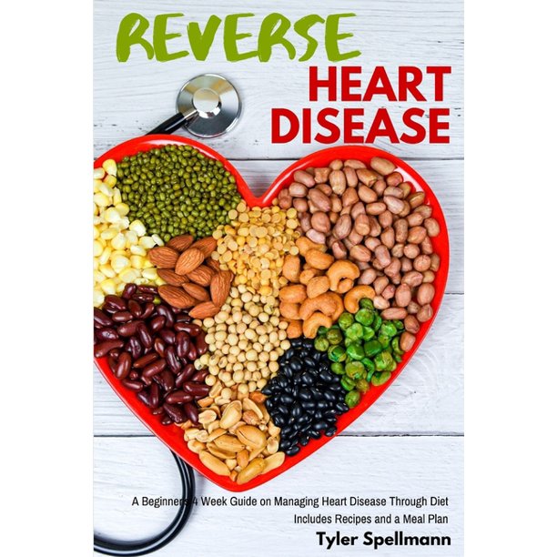 Reverse Heart Disease : A Beginner's 4 Week Guide on Managing Heart