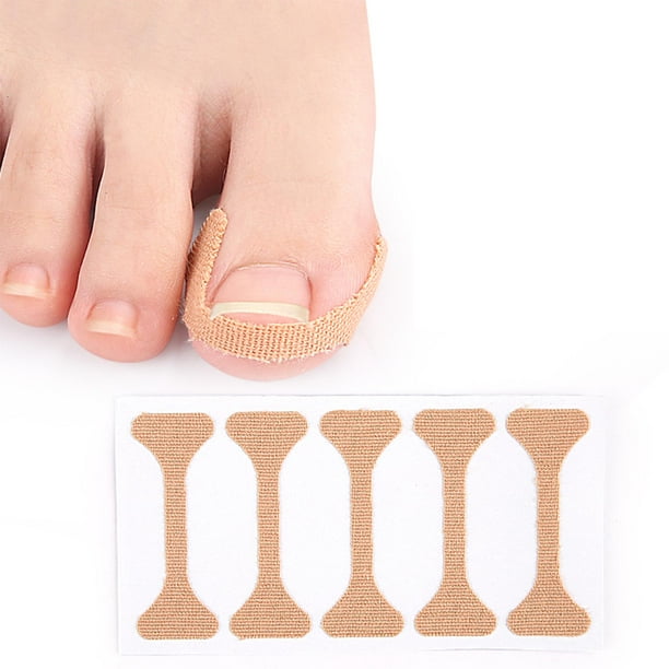 Pegatinas Correctoras De Uñas Encarnadas, Parche Corrector De Uñas Encarnadas Para Mujeres Yinane corrector de uñas encarnadas