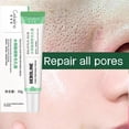 thumbnail image 3 of Crema retráctil de poros con ácido salicílico, eliminación rápida de poros grandes, eliminación de puntos negros, estiramiento de la cara, piel suave, producto coreano para el cuidado, 3 of 5