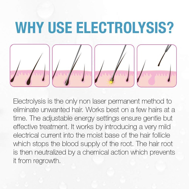 Is Electrolysis Hair Removal Permanent