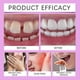 thumbnail image 5 of Thermoplastic Denture Adhesive, Zinc-Free Formula Long-Lasting Hold Up to 7 Days Secure Fit, 5 of 5