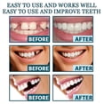 thumbnail image 2 of Dientes Dientes falsos temporales para una sonrisa instantánea y de confianza, carillas dentales para restauración temporal de dientes, 2 of 3