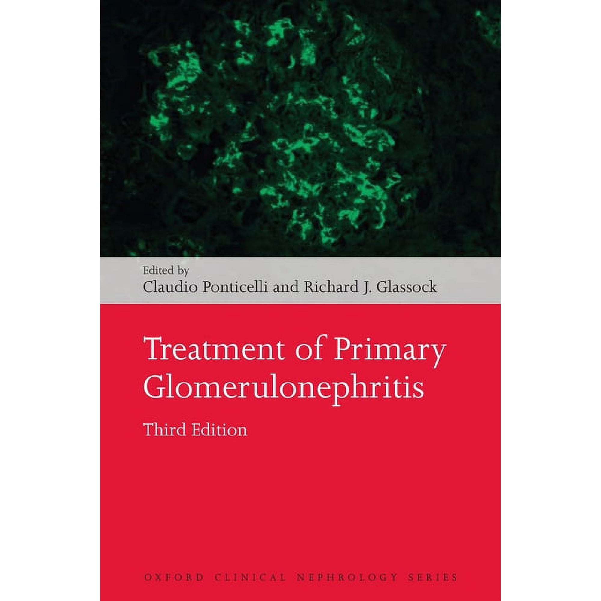 Oxford Clinical Nephrology Treatment of Primary Glomerulonephritis, (Paperback)