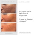 thumbnail image 5 of Murad Acne Control Clarifying Cleanser, Soothes Irritation, 5 fl oz, 5 of 8