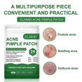 thumbnail image 1 of 48pcs Acne Pimple Spot Zit Patches Hydrocolloid Invisible Acne Stickers Skin Treatment, 1 of 2