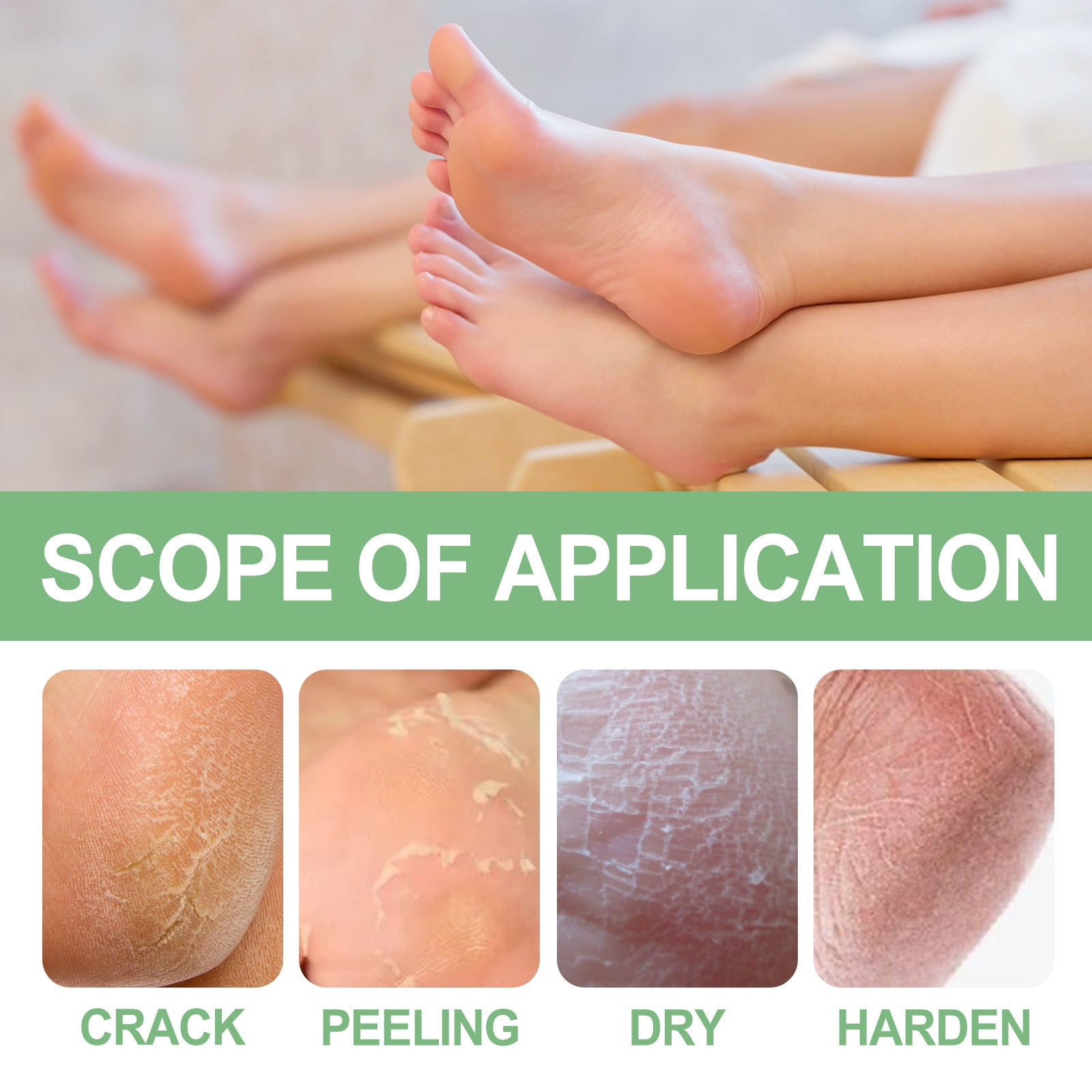 Heel Rescue Foot Cream For Cracked Calloused Or Chapped Skin Heel Exfoliation To Prevent Dry Cracked Calloused Feet