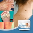 thumbnail image 4 of Eliminador de verrugas, crema para aliviar el dolor, verruga, topo, etiqueta de la piel, eliminar ungüento para el cuidado de la piel Ndcxsfigh Cuidado Belleza, 4 of 8