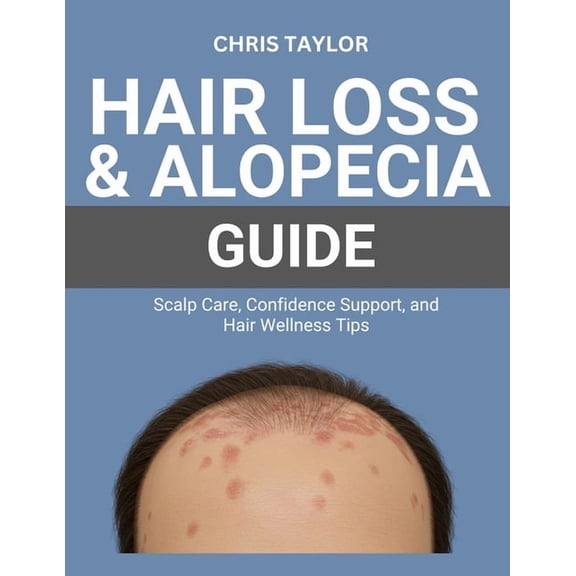Hair Loss & Alopecia Guide: Scalp Care, Confidence Support, and Hair Wellness Tips, (Paperback)