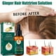 thumbnail image 2 of Aceite esencial para el cuidado del cabello, reparador del folículo piloso, líquido para el crecimiento del cabello, suavizante, seco, encrespado, aceite esencial nutritivo | 8109571191024,1 pieza, 2 of 5