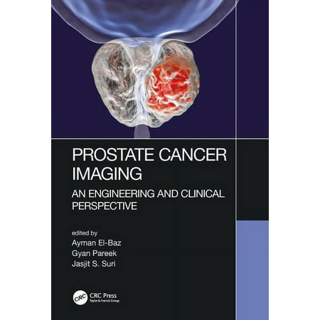 UPC: 9781498786232 | Prostate Cancer Imaging: An Engineering and Clinical Perspective (Hardcover)