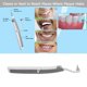 thumbnail image 2 of Electric Sonic Pic Tooth Stain Eraser Eliminador de placa Herramienta de blanqueamiento dental Ndcxsfigh Nuevos Originales, 2 of 6