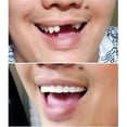 thumbnail image 4 of Veneer cosmetic teeth white teeth cover silicone simulation upper dentures simulation dentures plastic dentures, 4 of 5