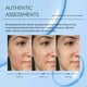 thumbnail image 4 of Sérum Facial Tanaceto Azul con Aceite de Nuez de Kukui Aceite de Jojoba Escualeno | Cuidado de la piel nutritivo, hidratante, antioxidante | Repara los poros Alivia el enrojecimiento | 30ml para, 4 of 8