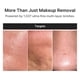 thumbnail image 5 of Dispositivo de limpieza facial Medicube Mini Booster Pro Plus rosa, 5 of 9