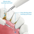 thumbnail image 3 of Electric Dental Calculus Remover Tooth Cleaner Tartar Remover USB Charging Teeth Cleaning Kit with Oral, 3 of 8