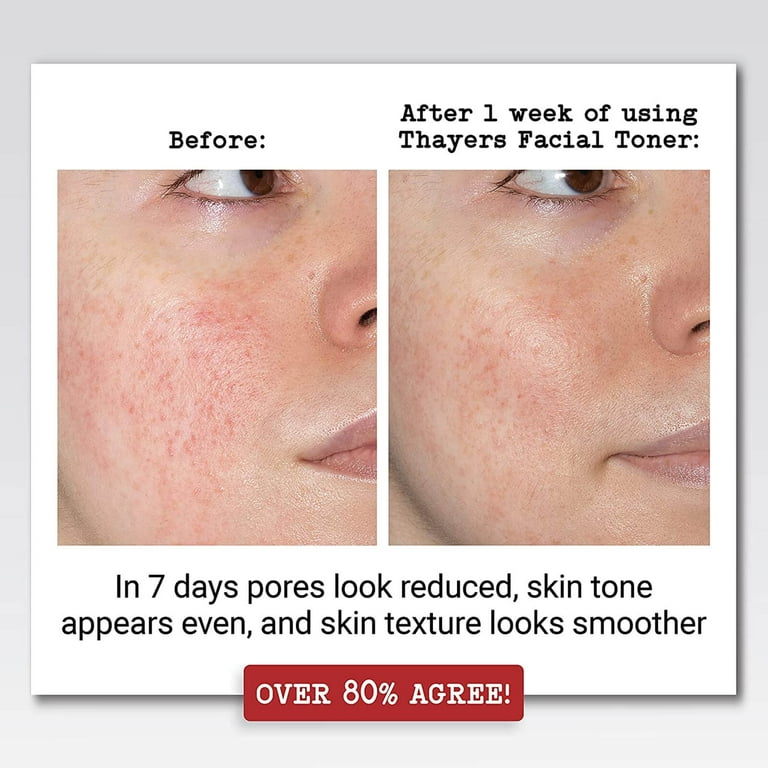 Thayers Unscented Witch Hazel and Aloe Vera Toner, 12 fl oz - Walmart.com