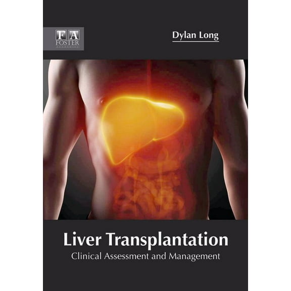 Liver Transplantation: Clinical Assessment and Management, (Hardcover)