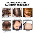 thumbnail image 1 of Jengibre Crecimiento del cabello Polvo Natural Fuerte Anti-rotura Construcción Recrecimiento Nutrir JShteea Cuidado Belleza, 1 of 8