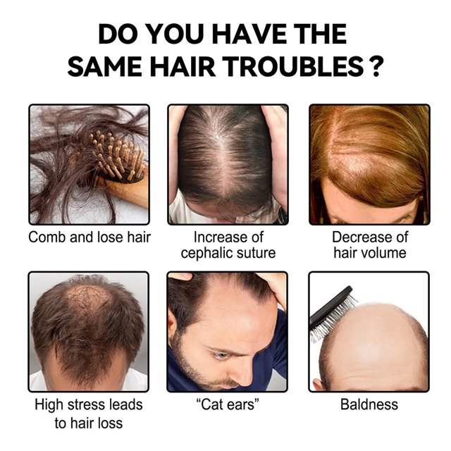 Jengibre Crecimiento del cabello Polvo Natural Fuerte Anti-rotura Construcción Recrecimiento Nutrir JShteea Cuidado Belleza