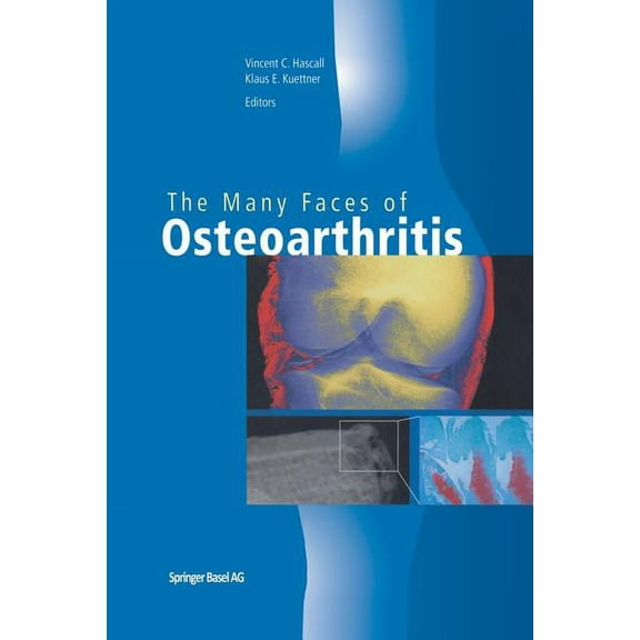 The Many Faces of Osteoarthritis, (Paperback)