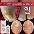 thumbnail image 2 of West & Month-Tratamiento de hongos Nailr, esencia para el cuidado de los pies, Gel antiinfección para la eliminación de hongos en las uñas de los pies, paroniquia y onicomicosis, 2 of 5