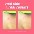 thumbnail image 2 of Spray corporal Dermalogica Clear Start Clarifying Bache 180 ml, 2 of 5