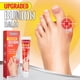 thumbnail image 5 of Crema De Gota Ungüento para aliviar el dolor de juanetes y gotas, 20g, masaje, crema para el dolor de los dedos de los pies, herramienta para el cuidado de los pies, 5 of 9