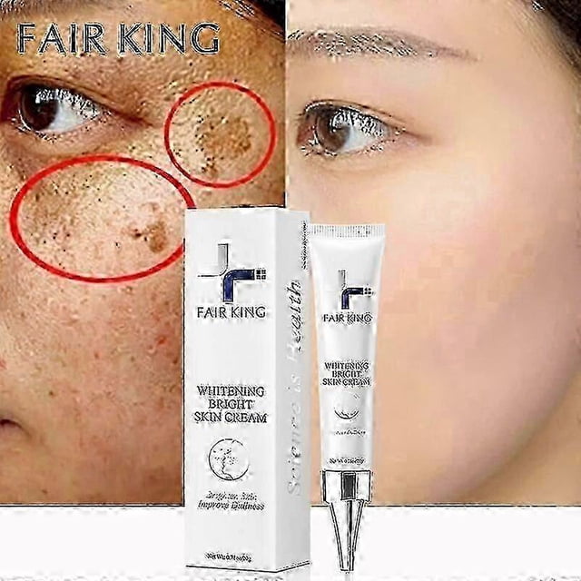 Effective Whitening Freckles Cream Remove Dark Spots Fade Melanin Anti-Pigmentation Improve Dullness Fast Brighten Skin Care New