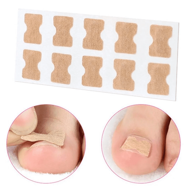 Parches De Corrección De Uñas Encarnadas 5 Blister Con 10 Parche C/u
