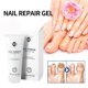 thumbnail image 2 of Healio Nail Treatment Gel Nail Care Gel Nail Thickening Nail Brightening Nail, 2 of 5