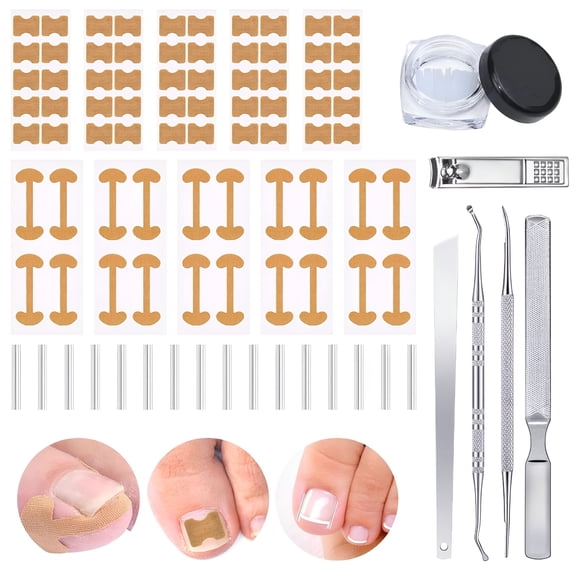 XIRQI Professional Ingrown Toenail Set with Breathable Ingrown Toenail Strips,Curved Toenails Corrector Patch,Painless File and Lifter Pedicure Tools for Women Man