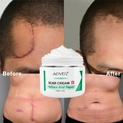 ALIVER Scar Cream, Stretch Marks Remover, Ideal for Acne, C-Section, Burns, Surgical Scars Treatment, Effective for Old and New Scars, 1.7 oz