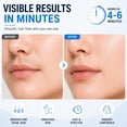 thumbnail image 2 of Hair Removal Cream for Women with  Repair Lotion, 4-Minute Gentle Depilatory for , Chin, Upper Lip & Sideburns -  & , 2.7 oz, 2 of 6