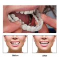 thumbnail image 5 of 2 Set Snap On Smile Teeth Veneers Whitening Cosmetic Denture, 5 of 5