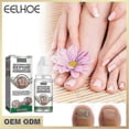 thumbnail image 2 of 3pcs EELHOE Anti Fungal Treatment Fungus Effective Finger Toe Nail Repair Liquid Solution -, 2 of 5