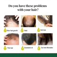 thumbnail image 4 of EELHOE ginger atomizing spray head long liquid tough hair massage scalp injury hair repair care solution, 4 of 5