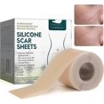 thumbnail image 1 of Silicone Plasters For Scars, Silicone Scar Films For Surgeries, Caesarean Section, Keloids, Burns,silicone Scar Tape-4cm*3m, 1 of 5