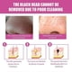 thumbnail image 2 of Jaysuing Aloe Vera Nose Patch Blackhead Remover Set Aloe Vera Gel 30g + Paper 40PCS + Cotton Swab 10PCS, 2 of 4