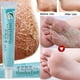 thumbnail image 1 of Teissuly Cracked Heel Balm Cream For Rough Dry & Cracked Chapped Feet Heel Skin Teissuly WER202401271558, 1 of 9