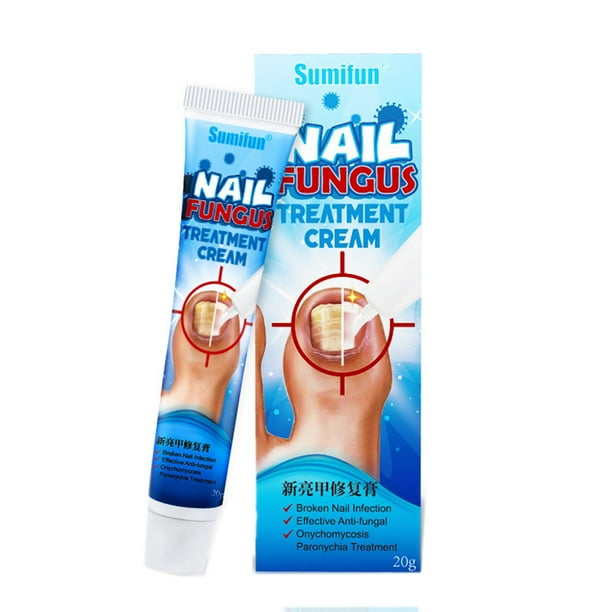 20g Chinese Herbal Toe Nail Fungus Treatment Cream Onychomycosis