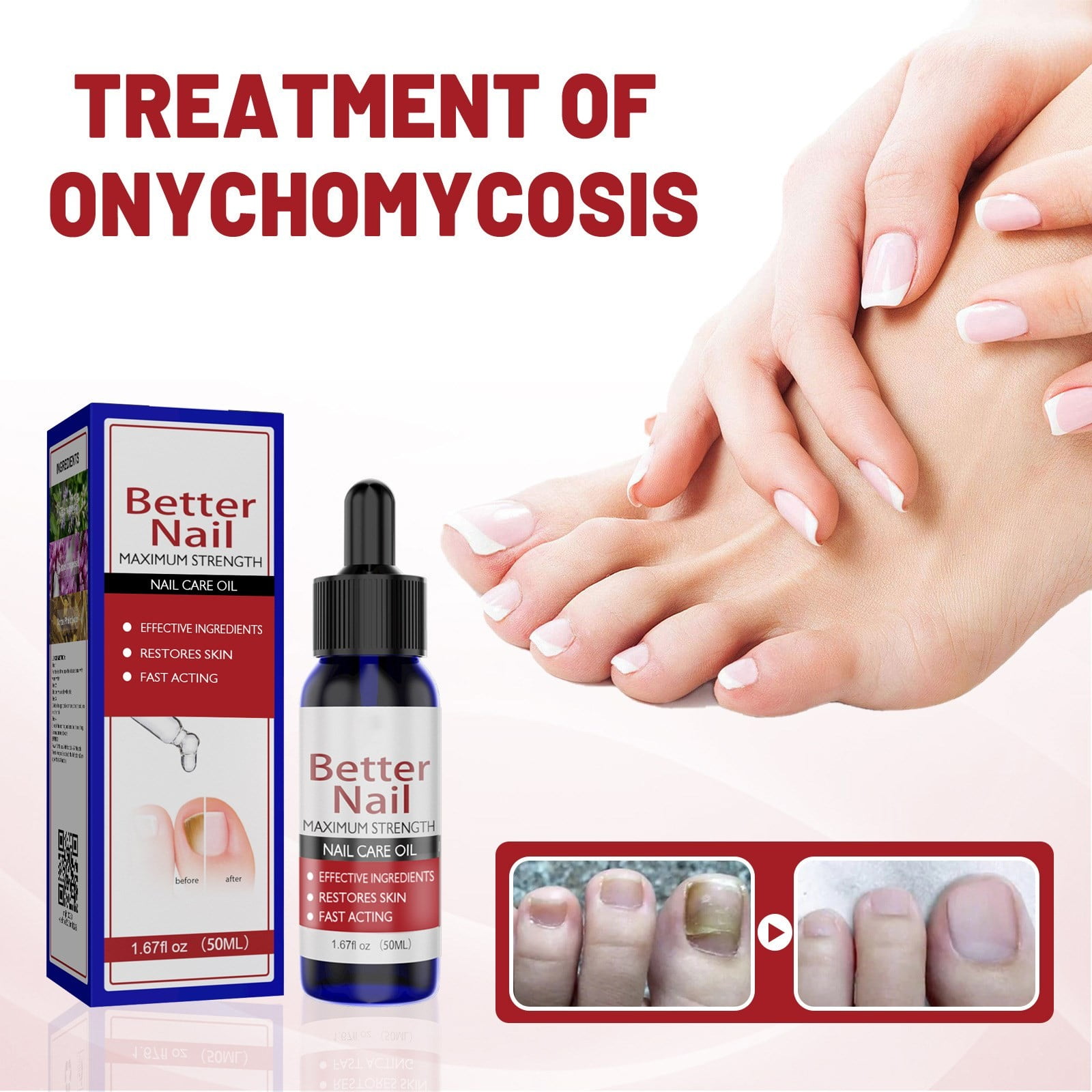 Yaiewey Better Nail Treatment for Fungus Under Around the Nail Maximum Strength 25 Solution for Nail Support Walmart