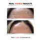 thumbnail image 5 of Serum Florence Big, eliminador de manchas oscuras antienvejecimiento con vitamina C, 60 ml, 5 of 6