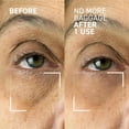 thumbnail image 2 of Paquete de equipaje Skincare Dr. Brandt Needles No More No More, 2 of 6